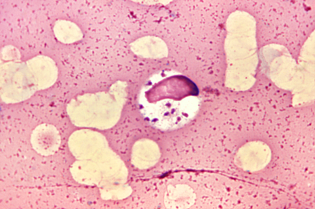 La panleucopenia destruye células intestinales y defensas del organismo.webp
